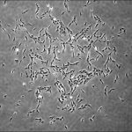 Study: Human skeletal stem cells identified — (Details)