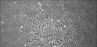 Study: Human skeletal stem cells identified — (Details)