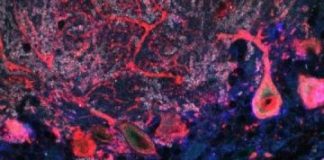 Study: Study of protein ‘trafficker’ provides insight into autism and other brain disorders — (Details)