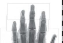 Research: CT technique expands possibilities of imaging ancient remains —