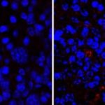 Study: Deciphering the link between skin allergies and the gut microbiota — (Details)