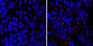 Study: Deciphering the link between skin allergies and the gut microbiota — (Details)