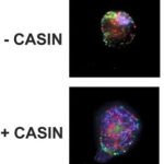 Study: Life-saving treatment for cancers and immune deficiencies comes with downsides — (Details)