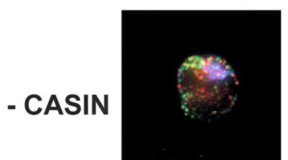 Study: Life-saving treatment for cancers and immune deficiencies comes with downsides — (Details)