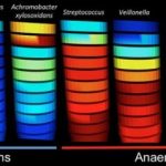 Study: For CF lung infections, how well antibiotics work may be affected by pH, oxygen — (Details)