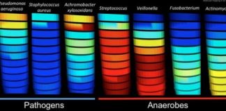 Study: For CF lung infections, how well antibiotics work may be affected by pH, oxygen — (Details)