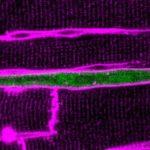 Study: Can we teach heart cells to grow up? — (Details) Elephant kills German tourist in Zimbabwe as she tried to take photo