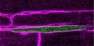 Study: Can we teach heart cells to grow up? — (Details) Elephant kills German tourist in Zimbabwe as she tried to take photo