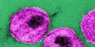 Study: Combination antibody therapy results in long-term viral suppression in HIV infection — (Details)