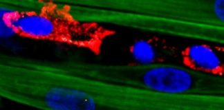 Study: Macrophages enable regeneration of lab-grown adult muscle tissue — (Details)