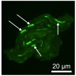 Study: Discoveries on antibiotic resistance — (Details)