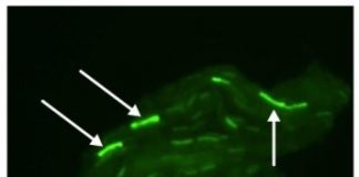 Study: Discoveries on antibiotic resistance — (Details)