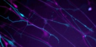 Study: A major step towards preventing neurons from dying — (Details)