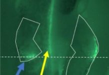 Research: Discovery has implications for understanding regeneration, wound repair, and diagnostic strategies —