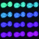 Study: New method offers potential means for detection of disease — (Details)