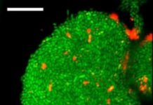 Research: How fatal biofilms form —