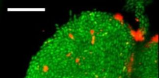 Research: How fatal biofilms form —