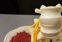 Tech: Biodegradable implant provides electrical stimulation that speeds nerve regeneration — (Report)