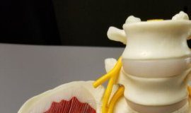 Tech: Biodegradable implant provides electrical stimulation that speeds nerve regeneration — (Report)