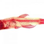 Study: Children with severely curved spines may be unable to use manganese — (Details)