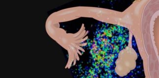 Study: New study shows that cancer cells hijack normal body chemistry — (Details)