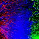 Study: Engineers develop process to 3-D print cells to produce human tissue such as ligaments and tendons — (Details)