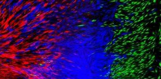 Study: Engineers develop process to 3-D print cells to produce human tissue such as ligaments and tendons — (Details)