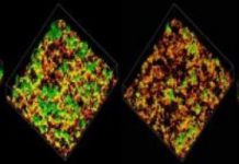 Research: What pneumococcus says to make you sick —