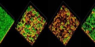 Research: What pneumococcus says to make you sick —