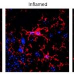 Study: Vagus nerve stimulation reduced inflammation and restored cognitive function after injury — (Details)
