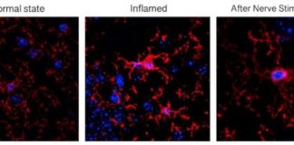 Study: Vagus nerve stimulation reduced inflammation and restored cognitive function after injury — (Details)