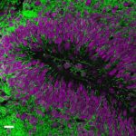 Study: Human brain cell transplant offers insights into neurological conditions — (Details)