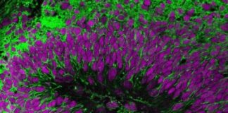 Study: Human brain cell transplant offers insights into neurological conditions — (Details)