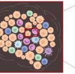 Study: In lung cancer study, tumor cells influence immune cells in their surroundings — (Details)