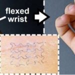 Study: Simple stickers may save lives of patients, athletes and lower medical costs — (Details)