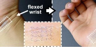 Study: Simple stickers may save lives of patients, athletes and lower medical costs — (Details)