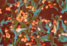 Research: Findings helped inform Nigeria’s public health response —