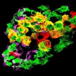 Study: Cells that change jobs to fight diabetes — (Details)