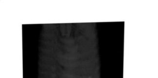 Study: MRI tool watches how electrical stimulation could cure digestive disorders — (Details)