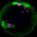 Study: Study could lead to treatments for some forms of infertility and fighting aggressive cancers — (Details)