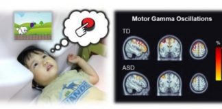 Study: Brainwave activity reveals potential biomarker for autism in children — (Details)