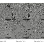 Study: Gene that inhibits HIV identified as a potential candidate for cancer treatments — (Details)