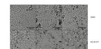 Study: Gene that inhibits HIV identified as a potential candidate for cancer treatments — (Details)