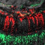 Study: Unique type of skeletal stem cells found in ‘resting zone’ are actually hard at work — (Details)