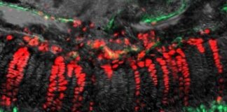 Study: Unique type of skeletal stem cells found in ‘resting zone’ are actually hard at work — (Details)