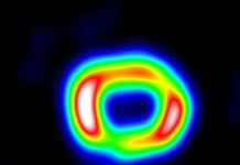 Tech: Thirty years in the life of supernova 1987A — (Report)