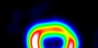 Tech: Thirty years in the life of supernova 1987A — (Report)