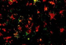 Research: Cooling ‘brains on fire’ to treat Parkinson’s —