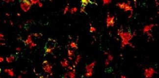 Research: Cooling ‘brains on fire’ to treat Parkinson’s —