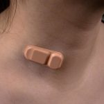 Study: Band-Aid-like device non-invasively monitors shunt performance in patients with hydrocephalus — (Details)